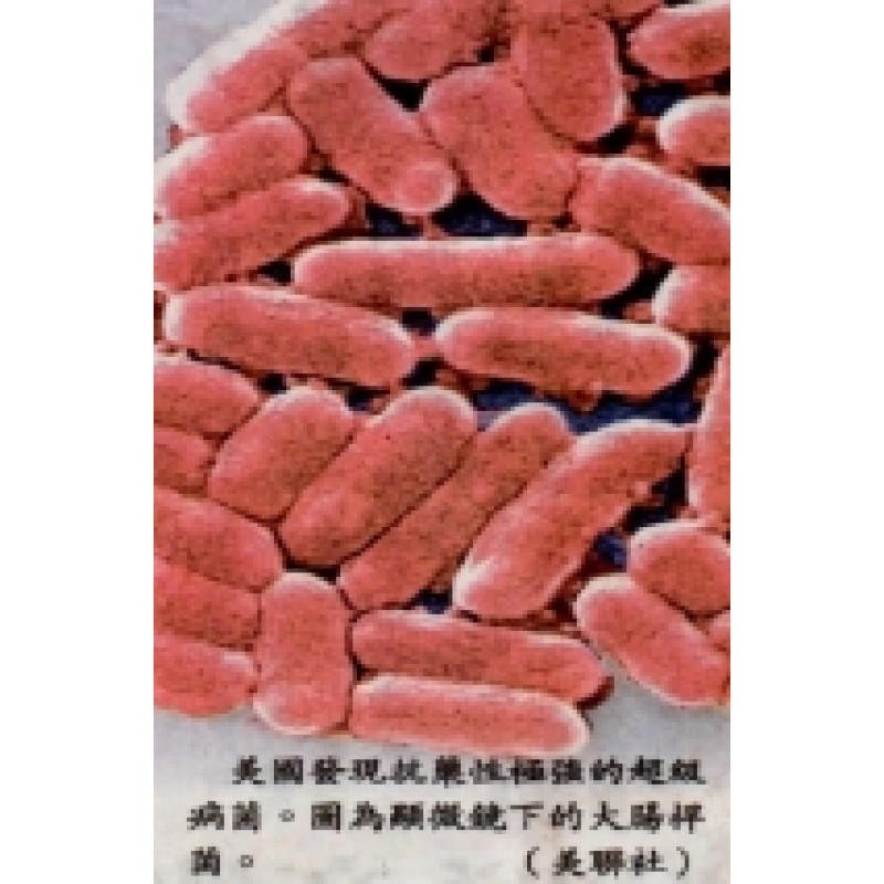超級細菌